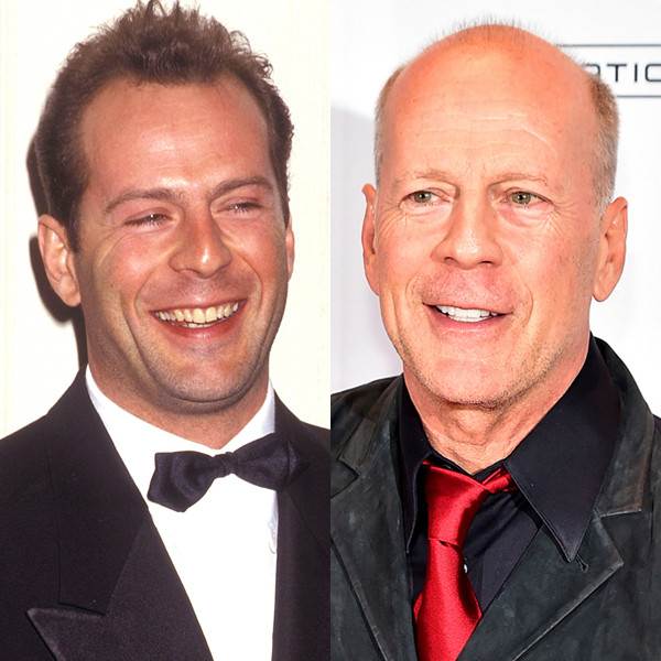 Bruce Willis, Hair
